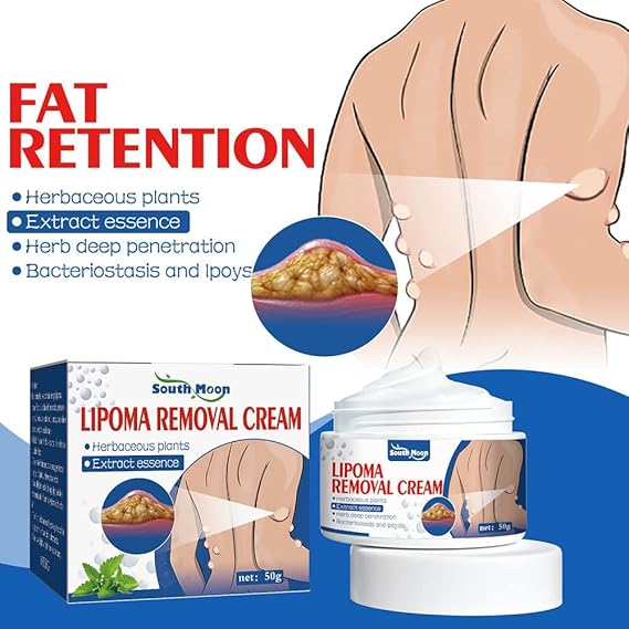 South Moon Lipoma Removal & Body Smoothing Cream - 50g - Herbal Natural Lump & Skin Knot Relief Ointment for Neck & Body